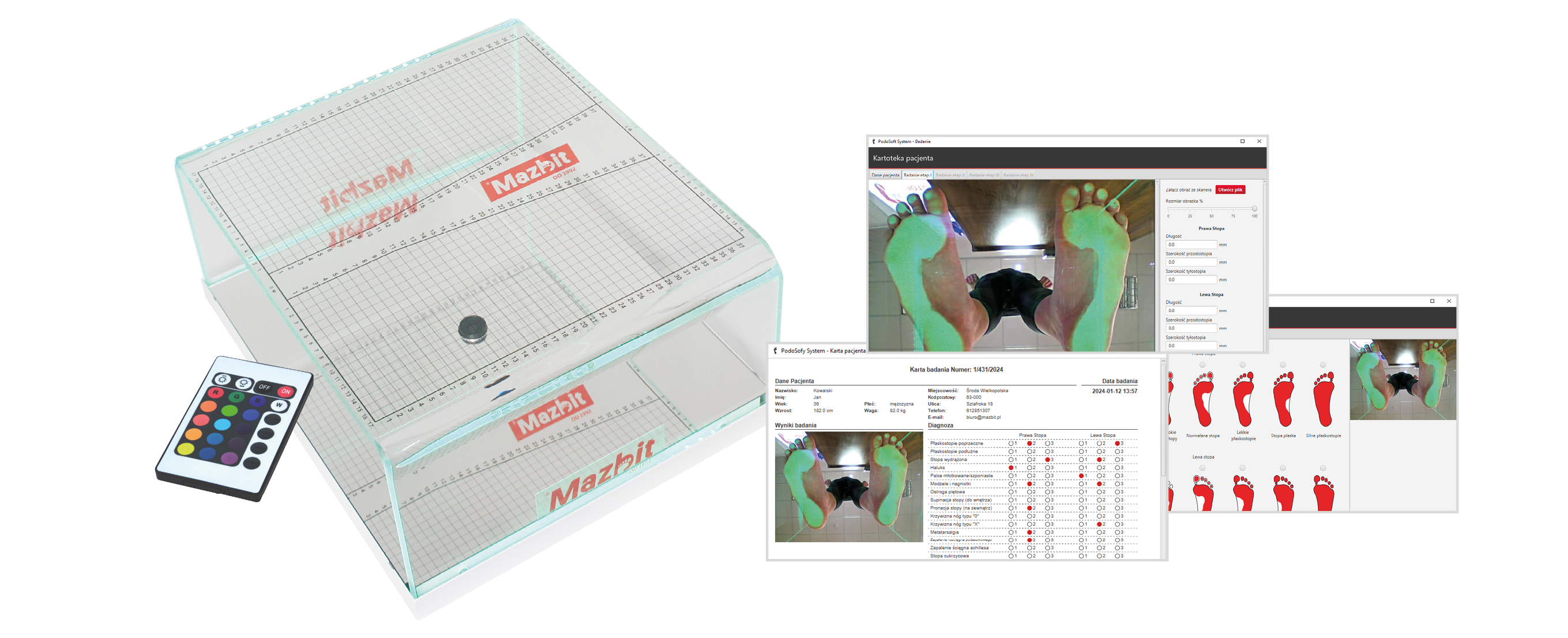 Podoskop diagnostyczny do badania stóp PODOSCOPE 4K MAZBIT